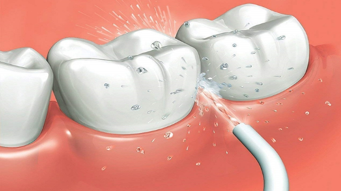 Water flosser adalah gadget terbaik untuk gigi yang membersihkan sisa makanan lebih ampuh dari dental floss. Mari kenali lebih jauh melalui pembahasan berikut!